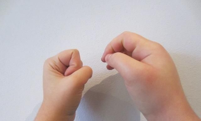 El Angioedema Hereditario (AEH) es una enfermedad genética poco frecuente y potencialmente mortal