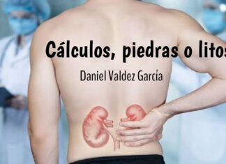 Cálculos, piedras o litis