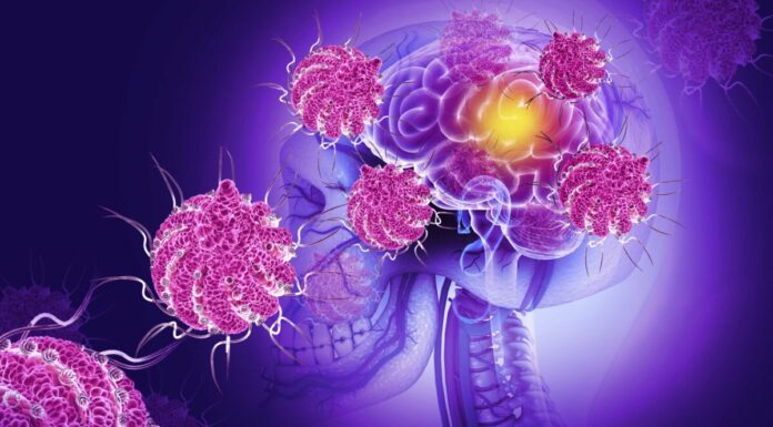 Alerta Global por Virus Nipah: ¿Estamos Frente a Una Nueva Amenaza Sanitaria?